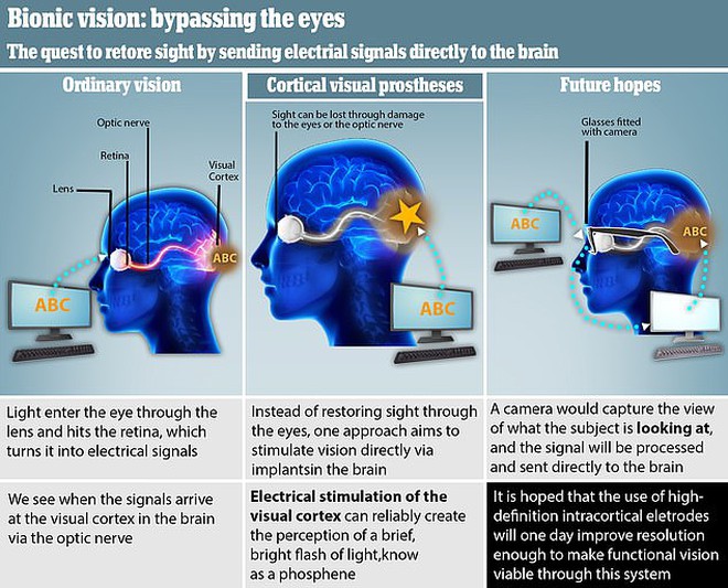 Cách hoạt động của thị giác nhân tạo